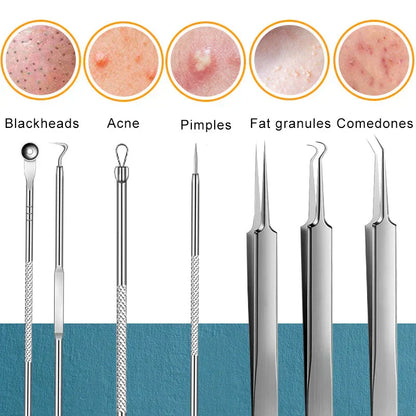 Blackhead Acne Set