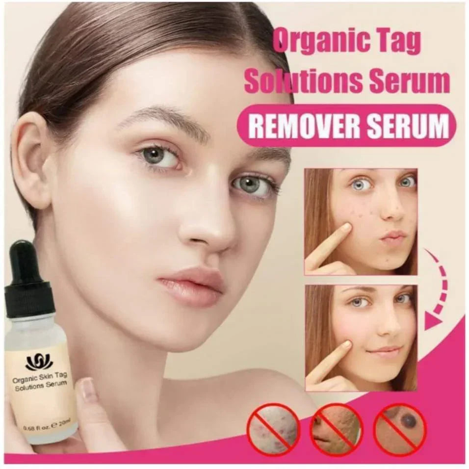 Natural Spots Free Serum