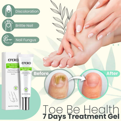 Nail Repair Treatment Gel