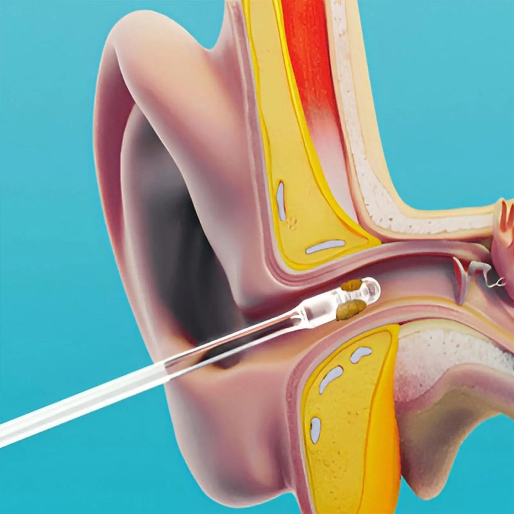 Reusable Ear Wax Remover